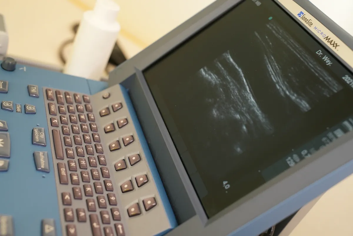 Ultraschallgerät mit Monitor und Steuereinheit